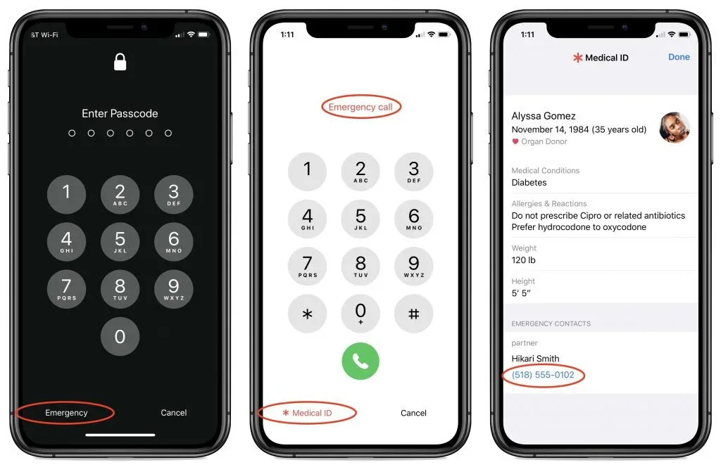 Three iPhone screens showing Emergency access and Medical ID information